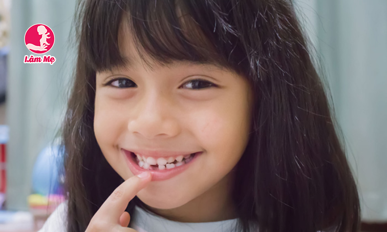 Trẻ 5 tuổi mọc răng hàm: dấu hiệu và cách chăm sóc